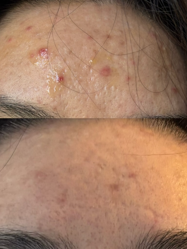 Before and after (unretouched)