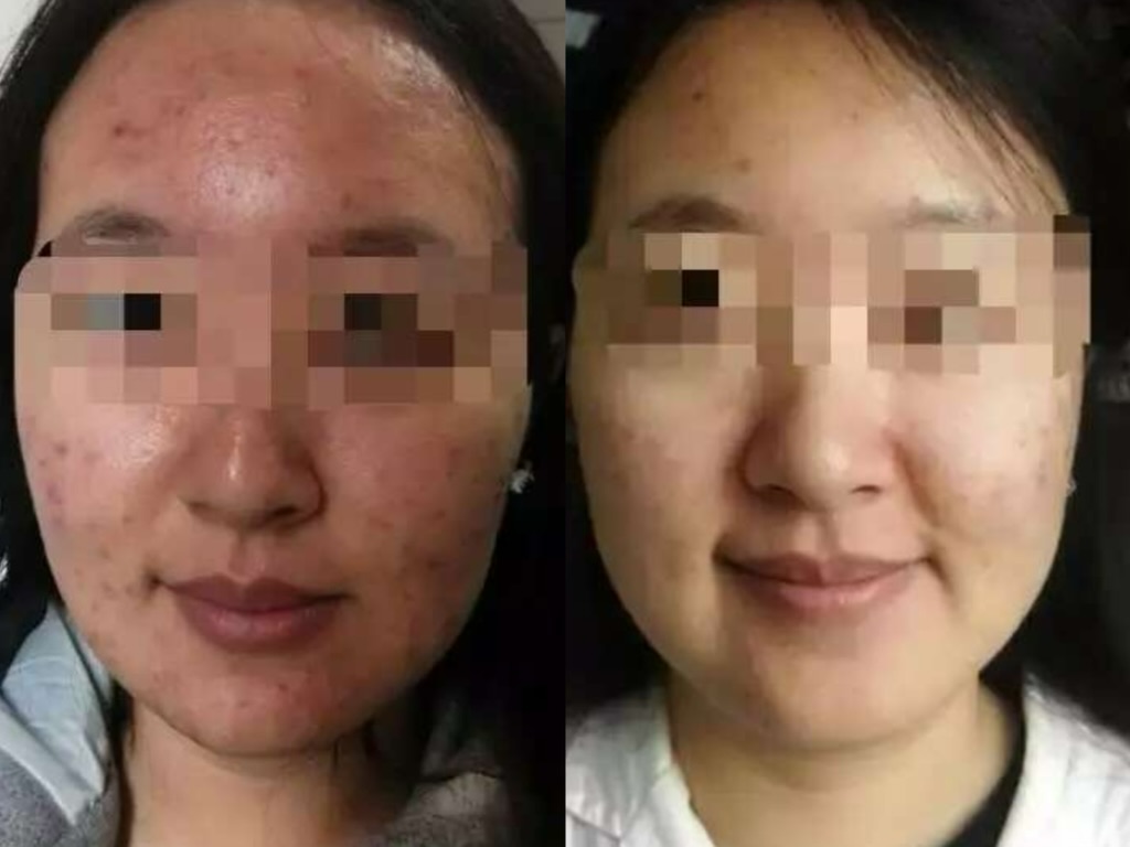 Before and after (unretouched)