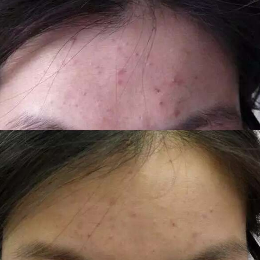 Before and after (unretouched)