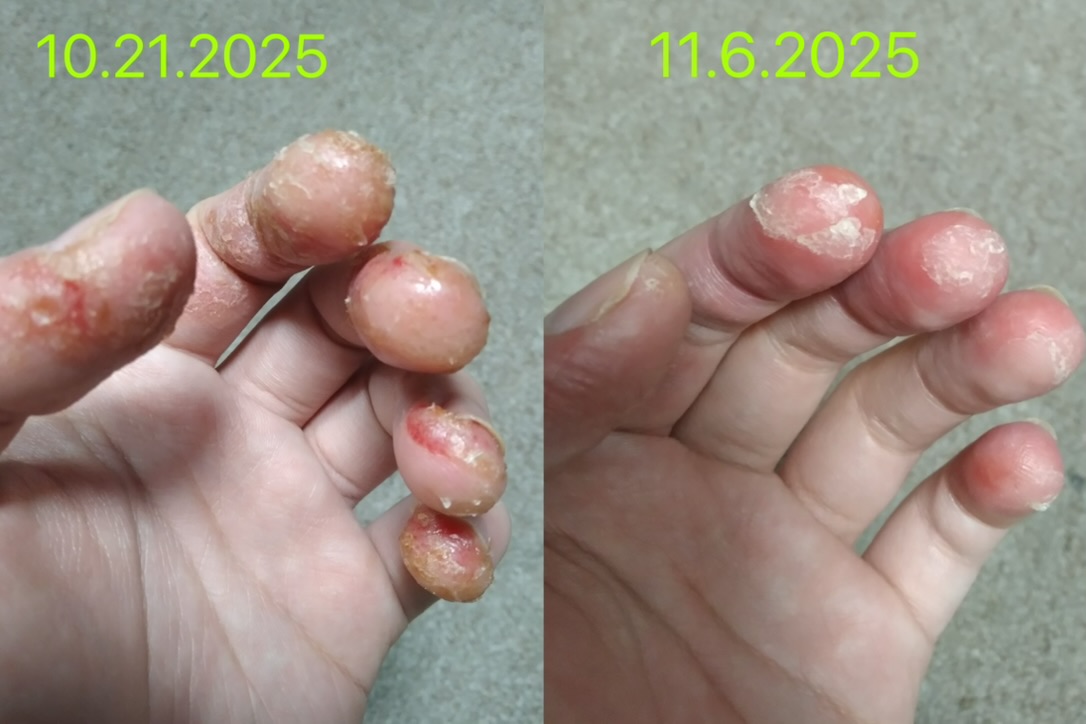 Before and after (unretouched)