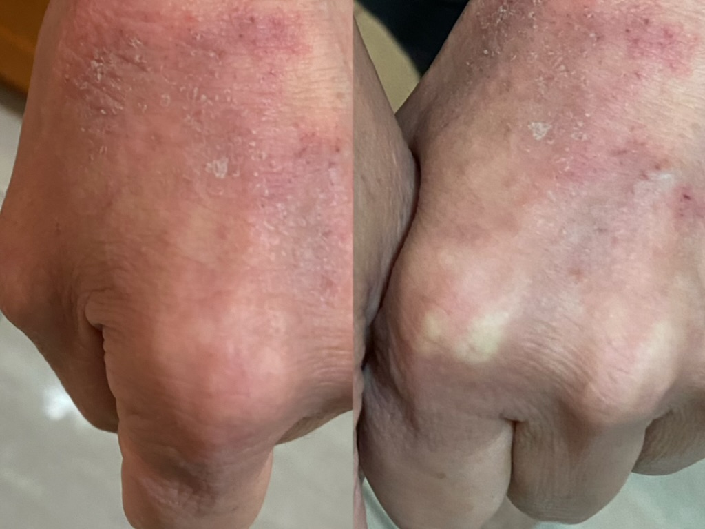 Before and after (unretouched)